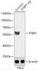Western blot analysis of extracts from normal (control) and PTBP1 knockout (KO) HeLa cells, using PTBP1 antibody (18-275) at 1:1000 dilution.<br/>Secondary antibody: HRP Goat Anti-Rabbit IgG (H+L) at 1:10000 dilution.<br/>Lysates/proteins: 25ug per lane.<br/>Blocking buffer: 3% nonfat dry milk in TBST.<br/>Detection: ECL Basic Kit.<br/>Exposure time: 1s.