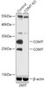 Western blot analysis of extracts from normal (control) and COMT knockout (KO) 293T cells, using COMT antibody (18-276) at 1:1000 dilution.<br/>Secondary antibody: HRP Goat Anti-Rabbit IgG (H+L) at 1:10000 dilution.<br/>Lysates/proteins: 25ug per lane.<br/>Blocking buffer: 3% nonfat dry milk in TBST.<br/>Detection: ECL Basic Kit.<br/>Exposure time: 30s.