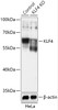 Western blot analysis of extracts from normal (control) and KLF4 knockout (KO) HeLa cells, using KLF4 antibody (18-279) at 1:1000 dilution.<br/>Secondary antibody: HRP Goat Anti-Rabbit IgG (H+L) at 1:10000 dilution.<br/>Lysates/proteins: 25ug per lane.<br/>Blocking buffer: 3% nonfat dry milk in TBST.<br/>Detection: ECL Basic Kit.<br/>Exposure time: 10s.