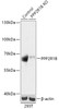 Western blot analysis of extracts from normal (control) and PPP2R1B knockout (KO) 293T cells, using PPP2R1B antibody (18-280) at 1:1000 dilution.<br/>Secondary antibody: HRP Goat Anti-Rabbit IgG (H+L) at 1:10000 dilution.<br/>Lysates/proteins: 25ug per lane.<br/>Blocking buffer: 3% nonfat dry milk in TBST.<br/>Detection: ECL Basic Kit.<br/>Exposure time: 60s.