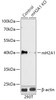 Western blot analysis of extracts from normal (control) and H2AFY knockout (KO) 293T cells, using H2AFY antibody (18-282) at 1:1000 dilution.<br/>Secondary antibody: HRP Goat Anti-Rabbit IgG (H+L) at 1:10000 dilution.<br/>Lysates/proteins: 25ug per lane.<br/>Blocking buffer: 3% nonfat dry milk in TBST.<br/>Detection: ECL Basic Kit.<br/>Exposure time: 60s.