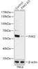 Western blot analysis of extracts from normal (control) and PAK2 knockout (KO) HeLa cells, using PAK2 antibody (18-284) at 1:1000 dilution.<br/>Secondary antibody: HRP Goat Anti-Rabbit IgG (H+L) at 1:10000 dilution.<br/>Lysates/proteins: 25ug per lane.<br/>Blocking buffer: 3% nonfat dry milk in TBST.<br/>Detection: ECL Basic Kit.<br/>Exposure time: 10s.