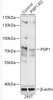 Western blot analysis of extracts from normal (control) and PSIP1 knockout (KO) 293T cells, using PSIP1 antibody (18-293) at 1:1000 dilution.<br/>Secondary antibody: HRP Goat Anti-Rabbit IgG (H+L) at 1:10000 dilution.<br/>Lysates/proteins: 25ug per lane.<br/>Blocking buffer: 3% nonfat dry milk in TBST.<br/>Detection: ECL Basic Kit.<br/>Exposure time: 10s.