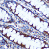 Immunohistochemistry of paraffin-embedded Human colon using HILPDA antibody (18-322) at dilution of 1:100 (40x lens) .