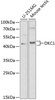 Western blot analysis of extracts of various cell lines, using DKC1 antibody (18-354) at 1:1000 dilution.<br/>Secondary antibody: HRP Goat Anti-Rabbit IgG (H+L) at 1:10000 dilution.<br/>Lysates/proteins: 25ug per lane.<br/>Blocking buffer: 3% nonfat dry milk in TBST.