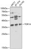 Western blot analysis of extracts of various cell lines, using TOR1A antibody (18-475) at 1:1000 dilution.<br/>Secondary antibody: HRP Goat Anti-Rabbit IgG (H+L) at 1:10000 dilution.<br/>Lysates/proteins: 25ug per lane.<br/>Blocking buffer: 3% nonfat dry milk in TBST.