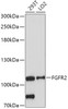 Western blot analysis of extracts of various cell lines, using FGFR2 antibody (18-480) at 1:1000 dilution.<br/>Secondary antibody: HRP Goat Anti-Rabbit IgG (H+L) at 1:10000 dilution.<br/>Lysates/proteins: 25ug per lane.<br/>Blocking buffer: 3% nonfat dry milk in TBST.<br/>Detection: ECL Basic Kit.<br/>Exposure time: 5min.