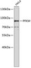 Western blot analysis of extracts of HeLa cells, using PFKM antibody (18-483) .<br/>Secondary antibody: HRP Goat Anti-Rabbit IgG (H+L) at 1:10000 dilution.<br/>Lysates/proteins: 25ug per lane.<br/>Blocking buffer: 3% nonfat dry milk in TBST.