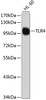 Western blot analysis of extracts of HL-60 cells, using TLR4 antibody (18-656) .<br/>Secondary antibody: HRP Goat Anti-Rabbit IgG (H+L) at 1:10000 dilution.<br/>Lysates/proteins: 25ug per lane.<br/>Blocking buffer: 3% nonfat dry milk in TBST.