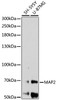 Western blot analysis of extracts of various cell lines, using MAP2 antibody (18-718) at 1:1000 dilution.<br/>Secondary antibody: HRP Goat Anti-Rabbit IgG (H+L) at 1:10000 dilution.<br/>Lysates/proteins: 25ug per lane.<br/>Blocking buffer: 3% nonfat dry milk in TBST.<br/>Detection: ECL Enhanced Kit.<br/>Exposure time: 5min.