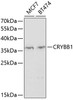 Western blot analysis of extracts of various cell lines, using CRYBB1 antibody (18-728) at 1:1000 dilution.<br/>Secondary antibody: HRP Goat Anti-Rabbit IgG (H+L) at 1:10000 dilution.<br/>Lysates/proteins: 25ug per lane.<br/>Blocking buffer: 3% nonfat dry milk in TBST.<br/>Detection: ECL Enhanced Kit.