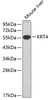 Western blot analysis of extracts of mouse liver, using KRT4 antibody (18-753) .<br/>Secondary antibody: HRP Goat Anti-Rabbit IgG (H+L) at 1:10000 dilution.<br/>Lysates/proteins: 25ug per lane.<br/>Blocking buffer: 3% nonfat dry milk in TBST.