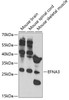 Western blot analysis of extracts of various cell lines, using EFNA3 antibody (18-788) at 1:1000 dilution._Secondary antibody: HRP Goat Anti-Rabbit IgG (H+L) at 1:10000 dilution._Lysates/proteins: 25ug per lane._Blocking buffer: 3% nonfat dry milk in TBST._Detection: ECL Enhanced Kit._Exposure time: 90s.