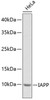 Western blot analysis of extracts of HeLa cells, using IAPP antibody (18-826) .<br/>Secondary antibody: HRP Goat Anti-Rabbit IgG (H+L) at 1:10000 dilution.<br/>Lysates/proteins: 25ug per lane.<br/>Blocking buffer: 3% nonfat dry milk in TBST.