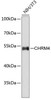Western blot analysis of extracts of NIH/3T3 cells, using CHRM4 antibody (18-839) .<br/>Secondary antibody: HRP Goat Anti-Rabbit IgG (H+L) at 1:10000 dilution.<br/>Lysates/proteins: 25ug per lane.<br/>Blocking buffer: 3% nonfat dry milk in TBST.