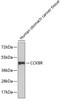 Western blot analysis of extracts of human stomach cancer tissue, using CCKBR antibody (18-877) .<br/>Secondary antibody: HRP Goat Anti-Rabbit IgG (H+L) at 1:10000 dilution.<br/>Lysates/proteins: 25ug per lane.<br/>Blocking buffer: 3% nonfat dry milk in TBST.