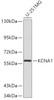 Western blot analysis of extracts of U-251MG cells, using KCNA1 antibody (18-898) .<br/>Secondary antibody: HRP Goat Anti-Rabbit IgG (H+L) at 1:10000 dilution.<br/>Lysates/proteins: 25ug per lane.<br/>Blocking buffer: 3% nonfat dry milk in TBST.