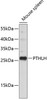 Western blot analysis of extracts of mouse spleen, using PTHLH antibody (18-983) .<br/>Secondary antibody: HRP Goat Anti-Rabbit IgG (H+L) at 1:10000 dilution.<br/>Lysates/proteins: 25ug per lane.<br/>Blocking buffer: 3% nonfat dry milk in TBST.