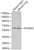 Western blot analysis of extracts of various cell lines, using PACSIN2 antibody (18-992) .<br/>Secondary antibody: HRP Goat Anti-Rabbit IgG (H+L) at 1:10000 dilution.<br/>Lysates/proteins: 25ug per lane.<br/>Blocking buffer: 3% nonfat dry milk in TBST.