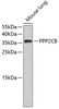 Western blot analysis of extracts of mouse lung, using PPP2CB antibody (19-013) .<br/>Secondary antibody: HRP Goat Anti-Rabbit IgG (H+L) at 1:10000 dilution.<br/>Lysates/proteins: 25ug per lane.<br/>Blocking buffer: 3% nonfat dry milk in TBST.