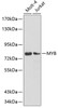 Western blot analysis of extracts of various cell lines, using MYB antibody (19-017) .<br/>Secondary antibody: HRP Goat Anti-Rabbit IgG (H+L) at 1:10000 dilution.<br/>Lysates/proteins: 25ug per lane.<br/>Blocking buffer: 3% nonfat dry milk in TBST.