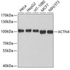 Western blot analysis of extracts of various cell lines, using ACTN4 antibody (19-019) .<br/>Secondary antibody: HRP Goat Anti-Rabbit IgG (H+L) at 1:10000 dilution.<br/>Lysates/proteins: 25ug per lane.<br/>Blocking buffer: 3% nonfat dry milk in TBST.