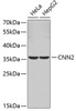 Western blot analysis of extracts of various cell lines, using CNN2 antibody (19-022) .<br/>Secondary antibody: HRP Goat Anti-Rabbit IgG (H+L) at 1:10000 dilution.<br/>Lysates/proteins: 25ug per lane.<br/>Blocking buffer: 3% nonfat dry milk in TBST.