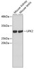 Western blot analysis of extracts of various cell lines, using UPK2 antibody (19-038) .<br/>Secondary antibody: HRP Goat Anti-Rabbit IgG (H+L) at 1:10000 dilution.<br/>Lysates/proteins: 25ug per lane.<br/>Blocking buffer: 3% nonfat dry milk in TBST.