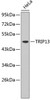 Western blot analysis of extracts of HeLa cells, using TRIP13 antibody (19-044) .<br/>Secondary antibody: HRP Goat Anti-Rabbit IgG (H+L) at 1:10000 dilution.<br/>Lysates/proteins: 25ug per lane.<br/>Blocking buffer: 3% nonfat dry milk in TBST.