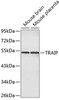 Western blot analysis of extracts of various cell lines, using TRAIP antibody (19-048) .<br/>Secondary antibody: HRP Goat Anti-Rabbit IgG (H+L) at 1:10000 dilution.<br/>Lysates/proteins: 25ug per lane.<br/>Blocking buffer: 3% nonfat dry milk in TBST.