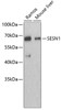 Western blot analysis of extracts of various cell lines, using SESN1 antibody (19-062) .<br/>Secondary antibody: HRP Goat Anti-Rabbit IgG (H+L) at 1:10000 dilution.<br/>Lysates/proteins: 25ug per lane.<br/>Blocking buffer: 3% nonfat dry milk in TBST.