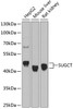 Western blot analysis of extracts of various cell lines, using SUGCT antibody (19-078) at 1:1000 dilution.<br/>Secondary antibody: HRP Goat Anti-Rabbit IgG (H+L) at 1:10000 dilution.<br/>Lysates/proteins: 25ug per lane.<br/>Blocking buffer: 3% nonfat dry milk in TBST.<br/>Detection: ECL Basic Kit.<br/>Exposure time: 30s.