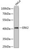 Western blot analysis of extracts of HeLa cells, using ERK2 antibody (19-110) .<br/>Secondary antibody: HRP Goat Anti-Rabbit IgG (H+L) at 1:10000 dilution.<br/>Lysates/proteins: 25ug per lane.<br/>Blocking buffer: 3% nonfat dry milk in TBST.