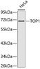 Western blot analysis of extracts of HeLa cells, using TOP1 antibody (19-119) .<br/>Secondary antibody: HRP Goat Anti-Rabbit IgG (H+L) at 1:10000 dilution.<br/>Lysates/proteins: 25ug per lane.<br/>Blocking buffer: 3% nonfat dry milk in TBST.