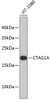 Western blot analysis of extracts of HT-1080 cells, using CTAG1A antibody (19-130) .<br/>Secondary antibody: HRP Goat Anti-Rabbit IgG (H+L) at 1:10000 dilution.<br/>Lysates/proteins: 25ug per lane.<br/>Blocking buffer: 3% nonfat dry milk in TBST.