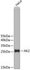 Western blot analysis of extracts of HeLa cells, using AK2 antibody (19-133) .<br/>Secondary antibody: HRP Goat Anti-Rabbit IgG (H+L) at 1:10000 dilution.<br/>Lysates/proteins: 25ug per lane.<br/>Blocking buffer: 3% nonfat dry milk in TBST.