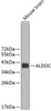 Western blot analysis of extracts of mouse brain, using ALDOC antibody (19-137) .<br/>Secondary antibody: HRP Goat Anti-Rabbit IgG (H+L) at 1:10000 dilution.<br/>Lysates/proteins: 25ug per lane.<br/>Blocking buffer: 3% nonfat dry milk in TBST.