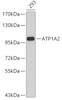 Western blot analysis of extracts of 293 cells, using ATP1A2 antibody (19-145) .<br/>Secondary antibody: HRP Goat Anti-Rabbit IgG (H+L) at 1:10000 dilution.<br/>Lysates/proteins: 25ug per lane.<br/>Blocking buffer: 3% nonfat dry milk in TBST.