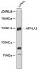 Western blot analysis of extracts of Jurkat cells, using ATP2A3 antibody (19-146) .<br/>Secondary antibody: HRP Goat Anti-Rabbit IgG (H+L) at 1:10000 dilution.<br/>Lysates/proteins: 25ug per lane.<br/>Blocking buffer: 3% nonfat dry milk in TBST.