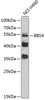 Western blot analysis of extracts of NCI-H460 cells, using BBS4 antibody (19-151) at 1:1000 dilution.<br/>Secondary antibody: HRP Goat Anti-Rabbit IgG (H+L) at 1:10000 dilution.<br/>Lysates/proteins: 25ug per lane.<br/>Blocking buffer: 3% nonfat dry milk in TBST.<br/>Detection: ECL Basic Kit.<br/>Exposure time: 30s.