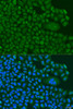 Immunofluorescence analysis of U2OS cells using BBS4 antibody (19-151) at dilution of 1:100. Blue: DAPI for nuclear staining.