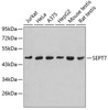 Western blot analysis of extracts of various cell lines, using SEPT7 antibody (19-158) .<br/>Secondary antibody: HRP Goat Anti-Rabbit IgG (H+L) at 1:10000 dilution.<br/>Lysates/proteins: 25ug per lane.<br/>Blocking buffer: 3% nonfat dry milk in TBST.