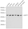 Western blot analysis of extracts of various cell lines, using SEPT7 antibody (19-158) .<br/>Secondary antibody: HRP Goat Anti-Rabbit IgG (H+L) at 1:10000 dilution.<br/>Lysates/proteins: 25ug per lane.<br/>Blocking buffer: 3% nonfat dry milk in TBST.