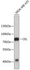 Western blot analysis of extracts of MDA-MB-435  cells, using CEL antibody (19-159) .<br/>Secondary antibody: HRP Goat Anti-Rabbit IgG (H+L) at 1:10000 dilution.<br/>Lysates/proteins: 25ug per lane.<br/>Blocking buffer: 3% nonfat dry milk in TBST.