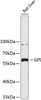 Western blot analysis of extracts of rat liver, using GPI antibody (19-202) .<br/>Secondary antibody: HRP Goat Anti-Rabbit IgG (H+L) at 1:10000 dilution.<br/>Lysates/proteins: 25ug per lane.<br/>Blocking buffer: 3% nonfat dry milk in TBST.