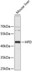 Western blot analysis of extracts of mouse liver, using HPD antibody (19-211) .<br/>Secondary antibody: HRP Goat Anti-Rabbit IgG (H+L) at 1:10000 dilution.<br/>Lysates/proteins: 25ug per lane.<br/>Blocking buffer: 3% nonfat dry milk in TBST.