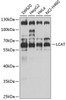 Western blot analysis of extracts of various cell lines, using LCAT antibody (19-222) at 1:1000 dilution.<br/>Secondary antibody: HRP Goat Anti-Rabbit IgG (H+L) at 1:10000 dilution.<br/>Lysates/proteins: 25ug per lane.<br/>Blocking buffer: 3% nonfat dry milk in TBST.<br/>Detection: ECL Basic Kit.<br/>Exposure time: 30s.