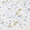 Immunohistochemistry of paraffin-embedded rat brain using LCAT antibody (19-222) at dilution of 1:100 (40x lens) .