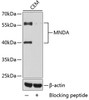 Western blot analysis of extracts of CEM cells, using MNDA antibody (19-229) .<br/>Secondary antibody: HRP Goat Anti-Rabbit IgG (H+L) at 1:10000 dilution.<br/>Lysates/proteins: 25ug per lane.<br/>Blocking buffer: 3% nonfat dry milk in TBST.