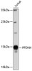 Western blot analysis of extracts of Jurkat cells, using PFDN4 antibody (19-246) .<br/>Secondary antibody: HRP Goat Anti-Rabbit IgG (H+L) at 1:10000 dilution.<br/>Lysates/proteins: 25ug per lane.<br/>Blocking buffer: 3% nonfat dry milk in TBST.